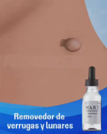 REMOVEDOR DE VERRUGA